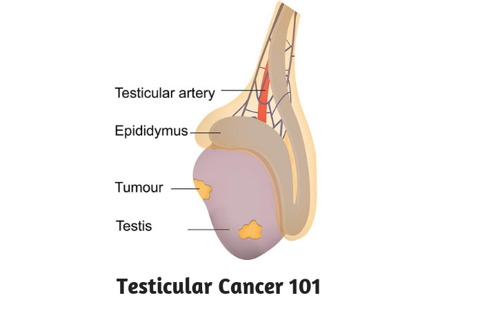 Testicular Cancer 101