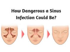 How Dangerous a Sinus Infection Could Be