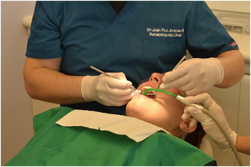 Sedation Dentistry For The Anxious Patients