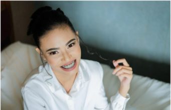 How Braces Improve Your Smile and Overall Oral Health