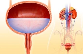 8 Bladder Control Tips To Deal With MS (Multiple Sclerosis)