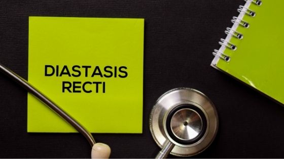 What is Diastasis Recti and How Can You Recover
