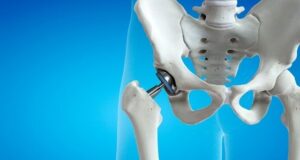 What Does An Orthopaedic Doctor Do For Pain Relief?