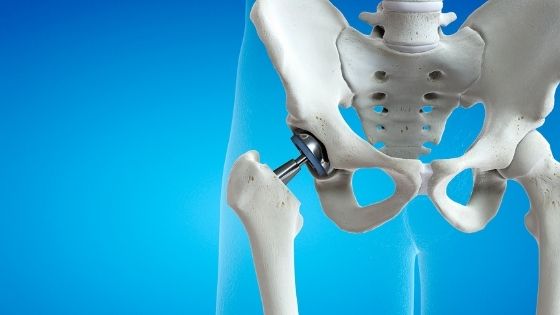 What Does An Orthopaedic Doctor Do For Pain Relief?