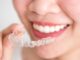 How Long Do Invisalign Braces Take to Work