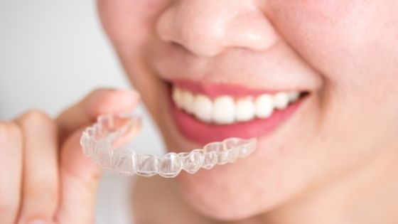 How Long Do Invisalign Braces Take to Work