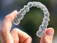 5 Reasons Why You Should Consider Invisalign Over Braces