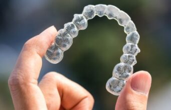 5 Reasons Why You Should Consider Invisalign Over Braces